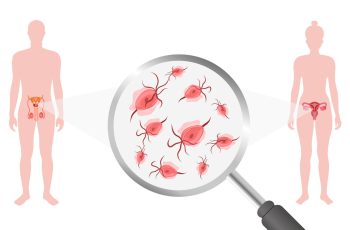 трихомонада: виявити та вилікувати