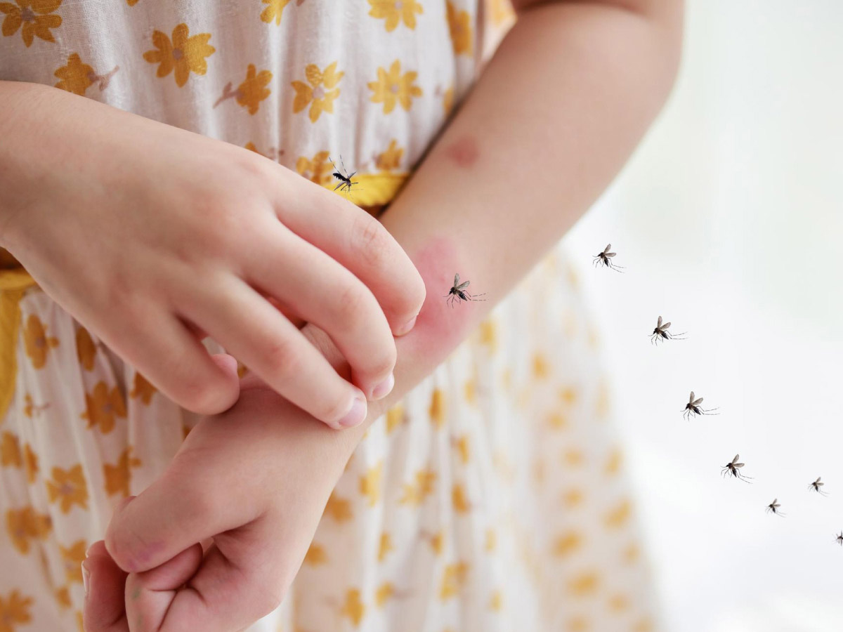 маленька дівчинка страждає від укусів комах та має подразення
