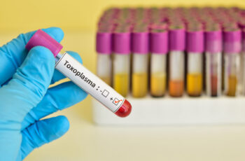 виконанення тесту на виявлення токсоплазми, зображення руки в одноразовій стерильній рукавичці, що тримає пробірку із біоматеріалом - кров'ю