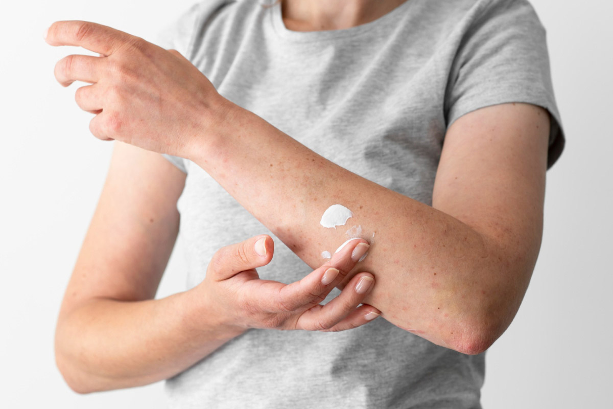 жінка наносить крем на шкіру рук