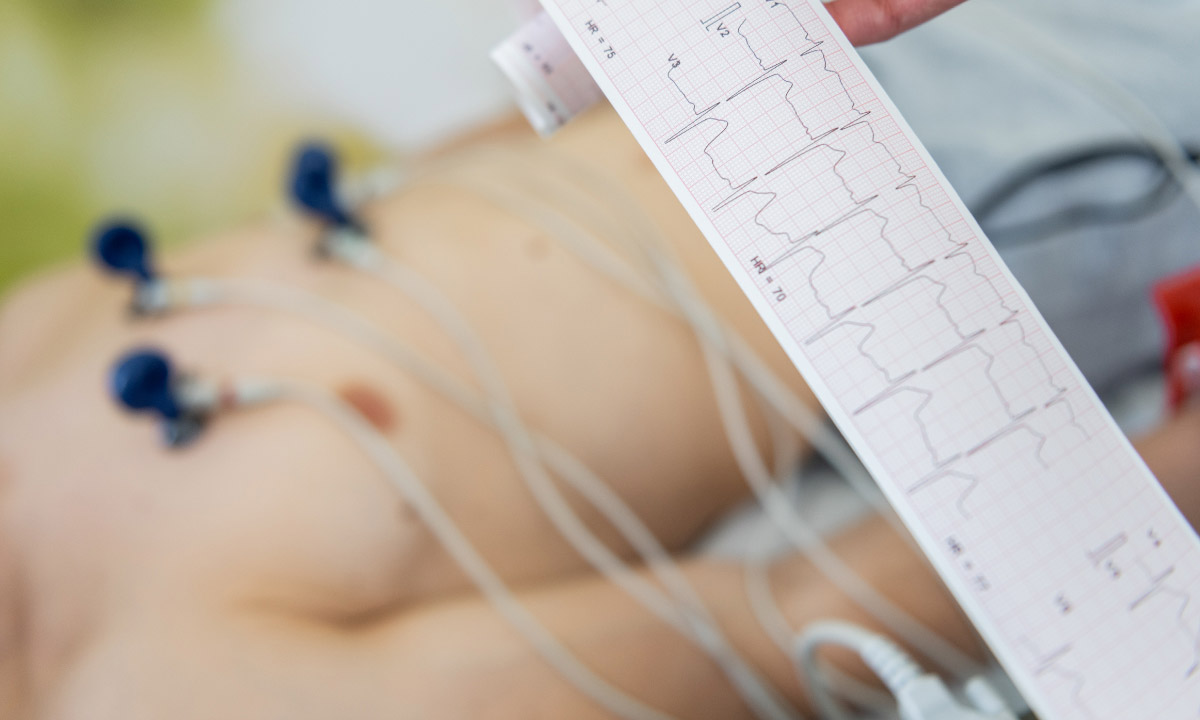 зображення на фото людини, яка проходить електрокардіограму