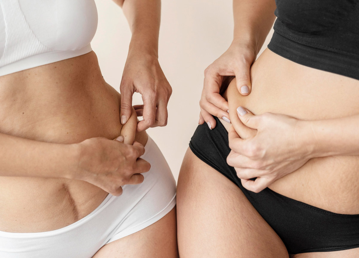 дві жінки тримають шкіру на талії, ніби-то порівнюючи