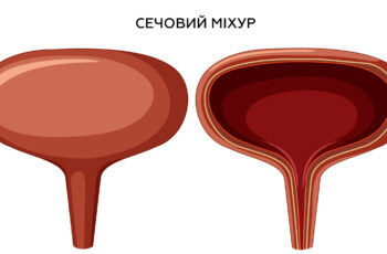 мальоване загальне зображення сечового міхура у розрізі