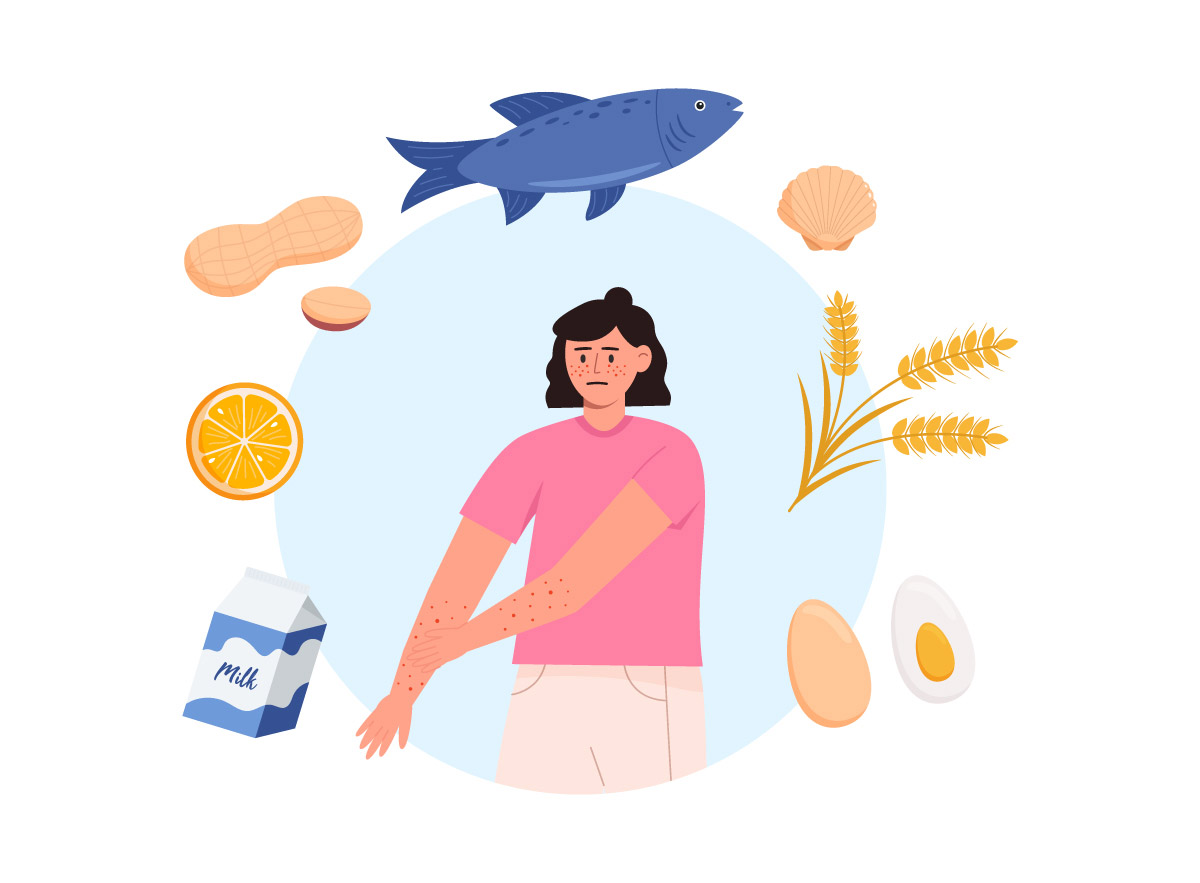 ілюстрація жінки, яка має алергічні прояви через харчову непереносимість