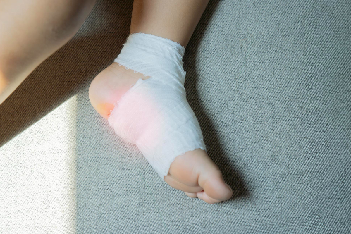 перев'язана ніжка дитини бинтом через поранення