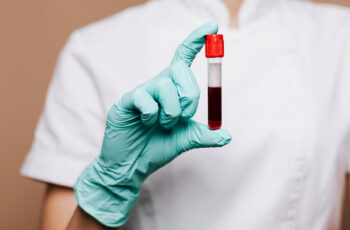 медсестра тримає в руці пробірку із набраною кров'ю для аналізу