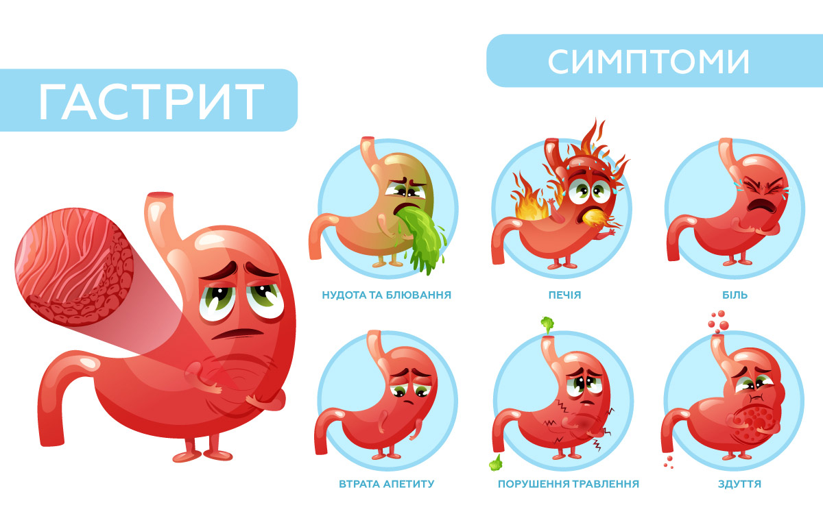 симптоми гастриту в мальованих зображеннях