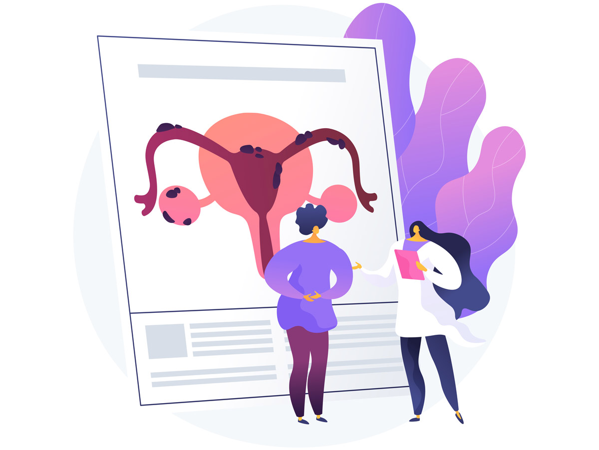 ендометріоз на картинці, обговорення, мальоване зображення