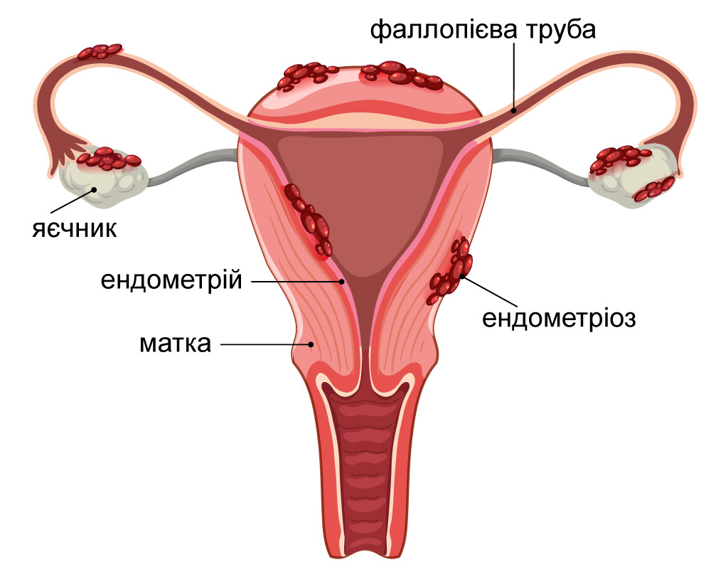 мальоване зображення матки та її складових