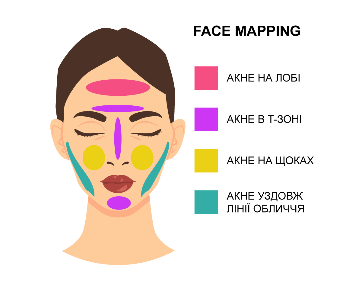 кольорове зображення різних зон обличчя, на яких можуть бути висипи