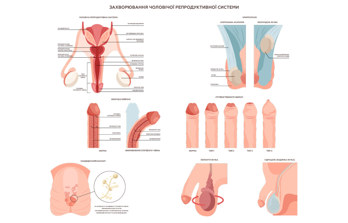 чоловіча репродуктивна система та захворювання