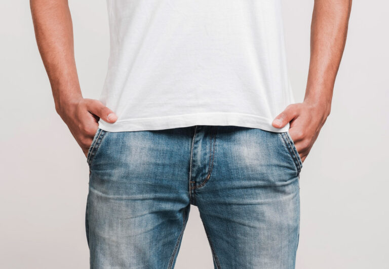 Що таке фімоз, які симптоми та як його лікують