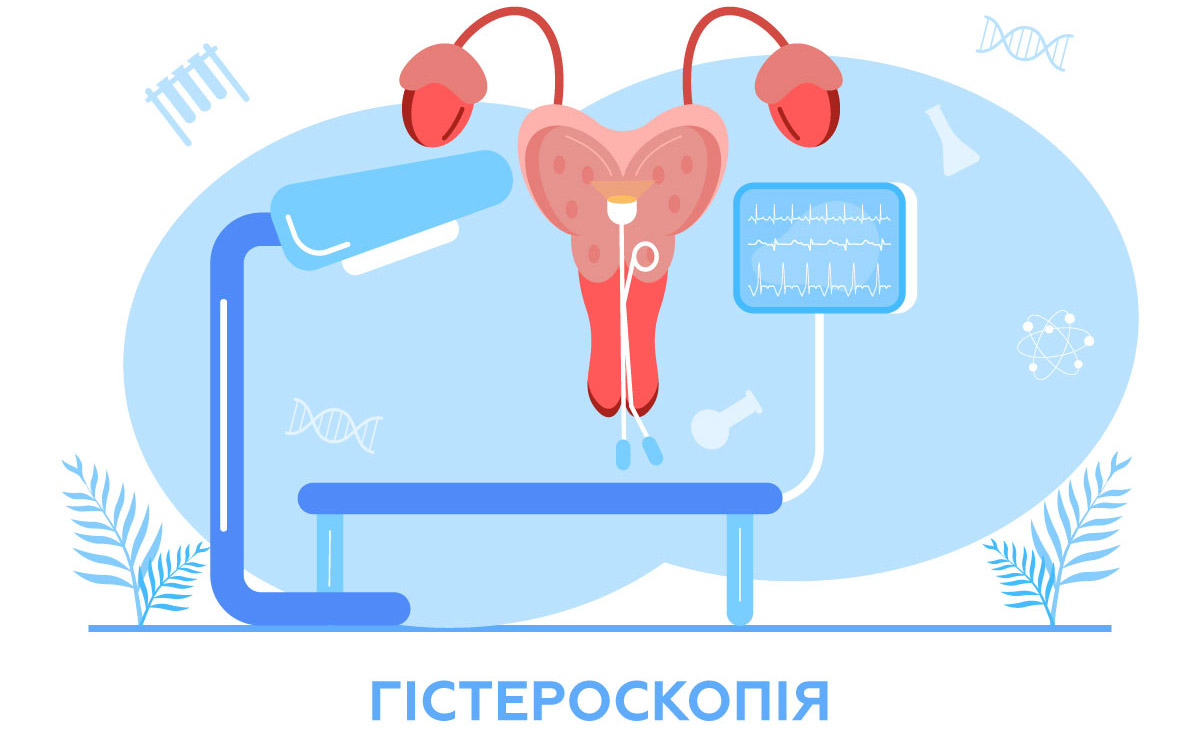 малоьване зображення матки