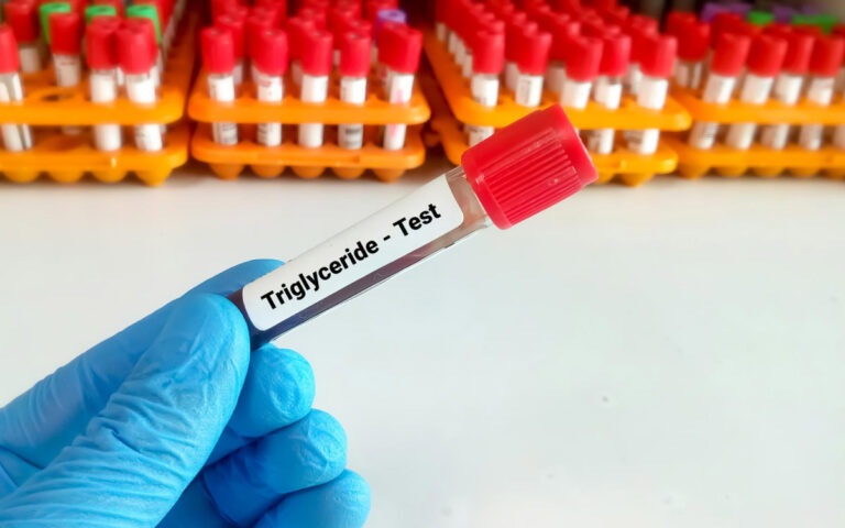 Тригліцериди в крові: норма для жінок та чоловіків, підвищені і знижені рівні тригліцеридів у крові