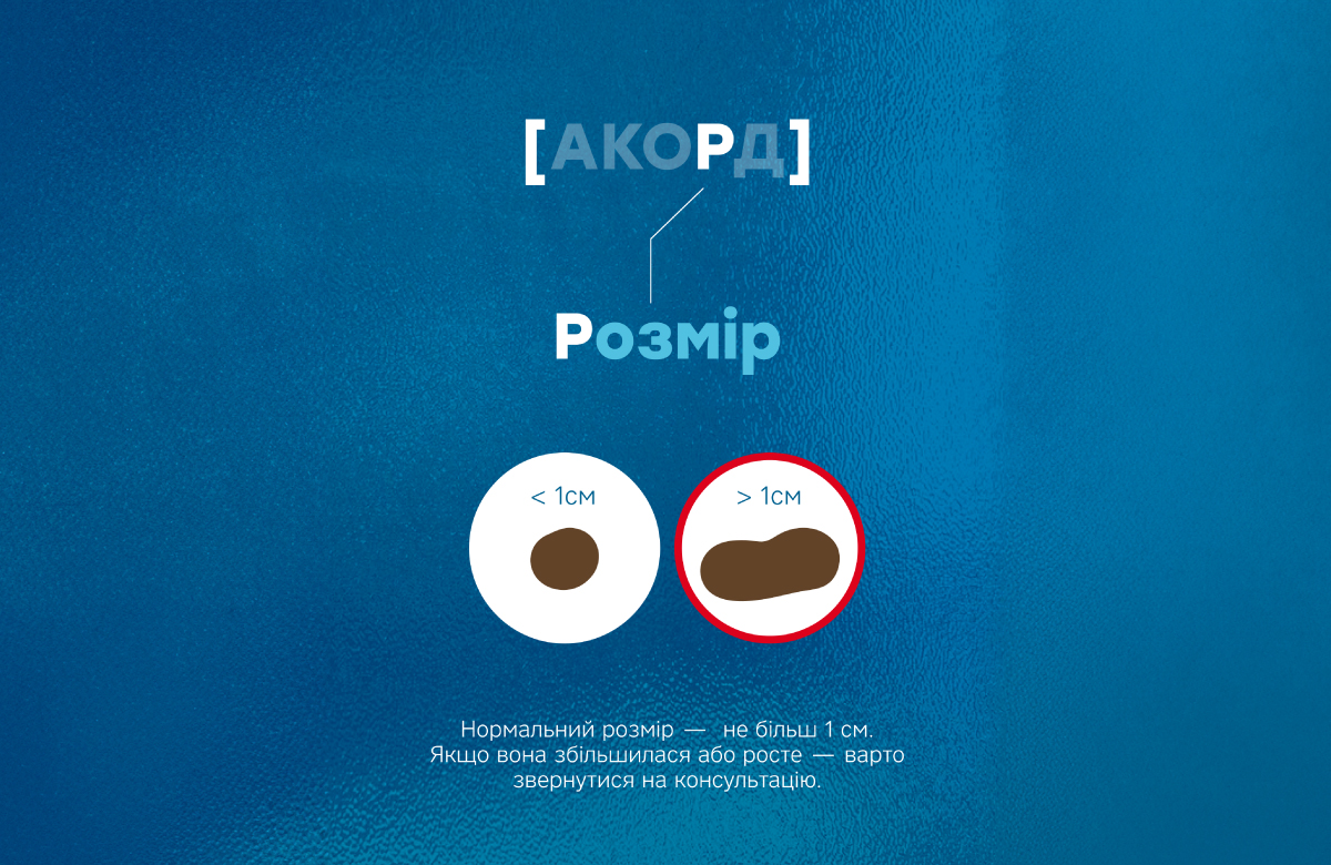 правило АКОРД &ndash; небезпечні симптоми, що робити, коли болить родимка