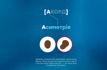 правило АКОРД – як впізнати злоякісні родимки