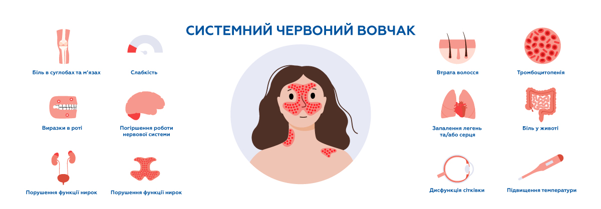 Симптоми червоного вовчака на різних стадіях